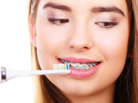 Jaka jest najlepsza pasta ortodontyczna? (ranking)