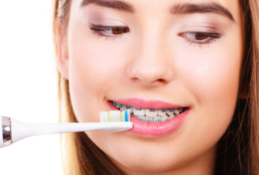 Jaka jest najlepsza pasta ortodontyczna? (ranking)